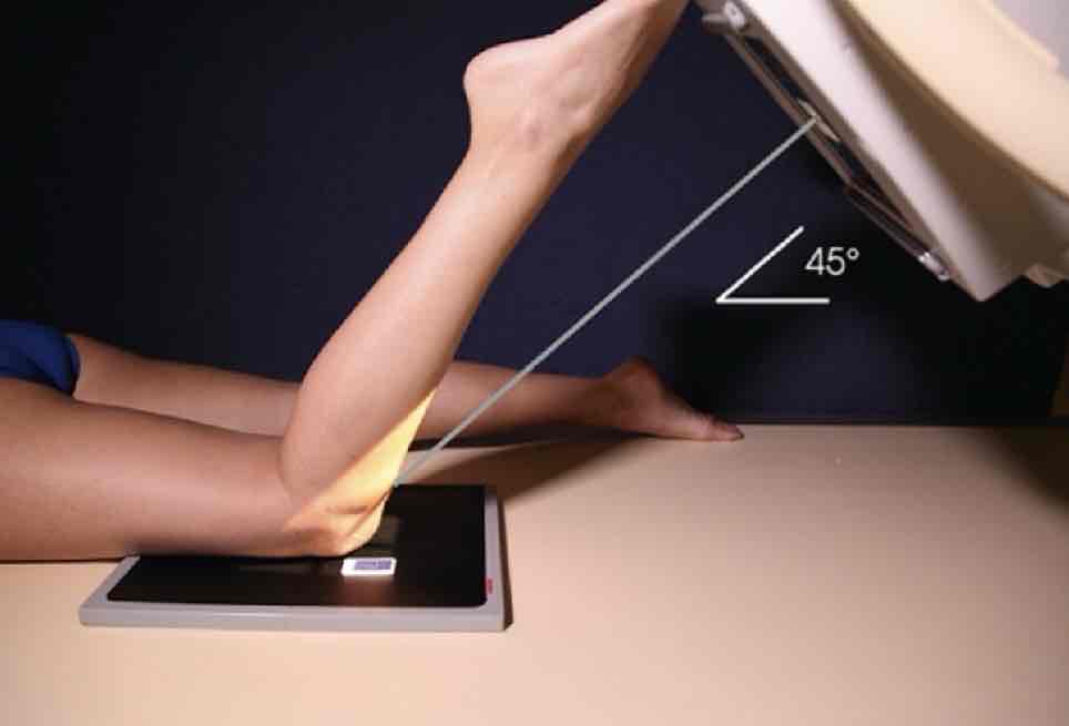 <p>What Projection is this?</p>