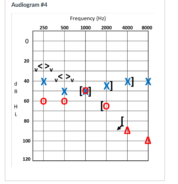 <p><strong>True or False</strong><span>: The symbol for vibrotactile response indicates that the patient definitely heard and felt the stimulus presented</span><strong>:</strong></p>