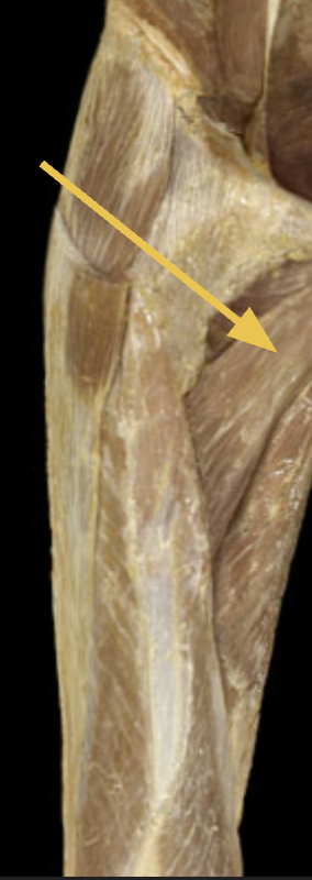 <p>identify + state origin, insertion, action, innervation of marked structure</p>