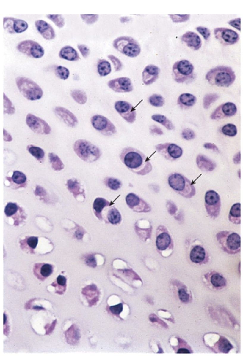 <p>How does an active chondrocyte appear under light microscopy? (3)</p>