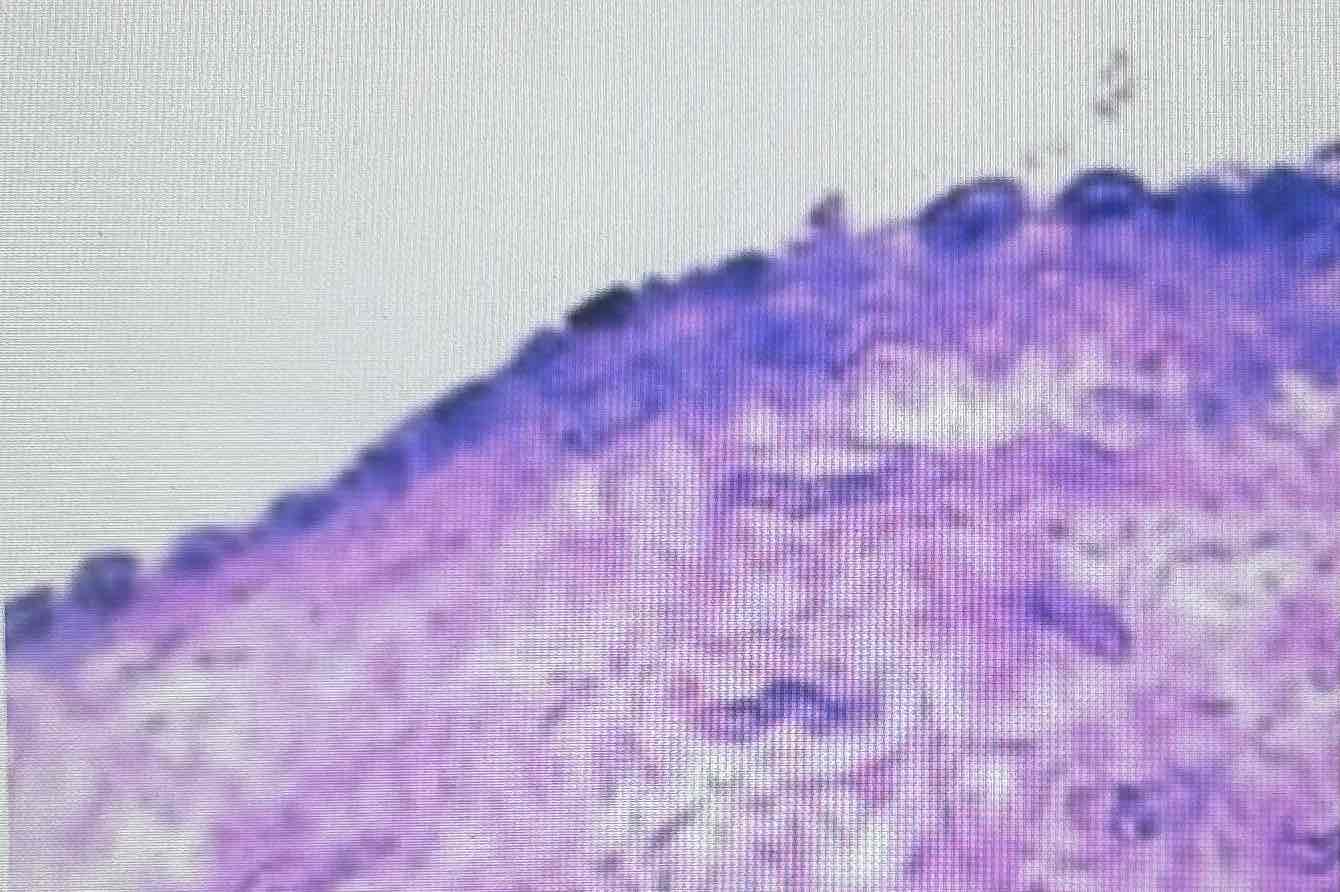 <p>Simple Squamous</p>