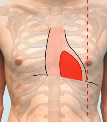 imaginary vertical line bisecting the middle of the clavicle in each hemithorax