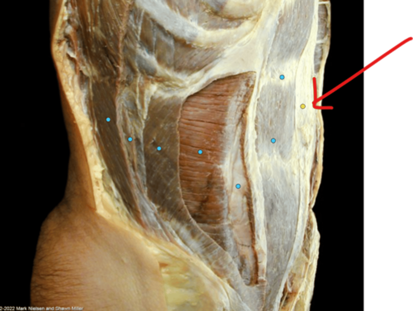 knowt flashcard image