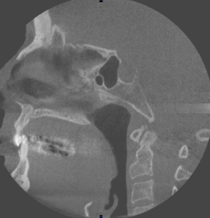 <p>what is the location of this slice </p>