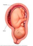 Placenta