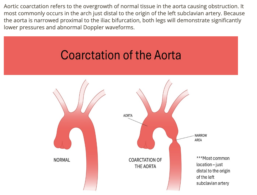 <p>a) aortic coarctation </p>