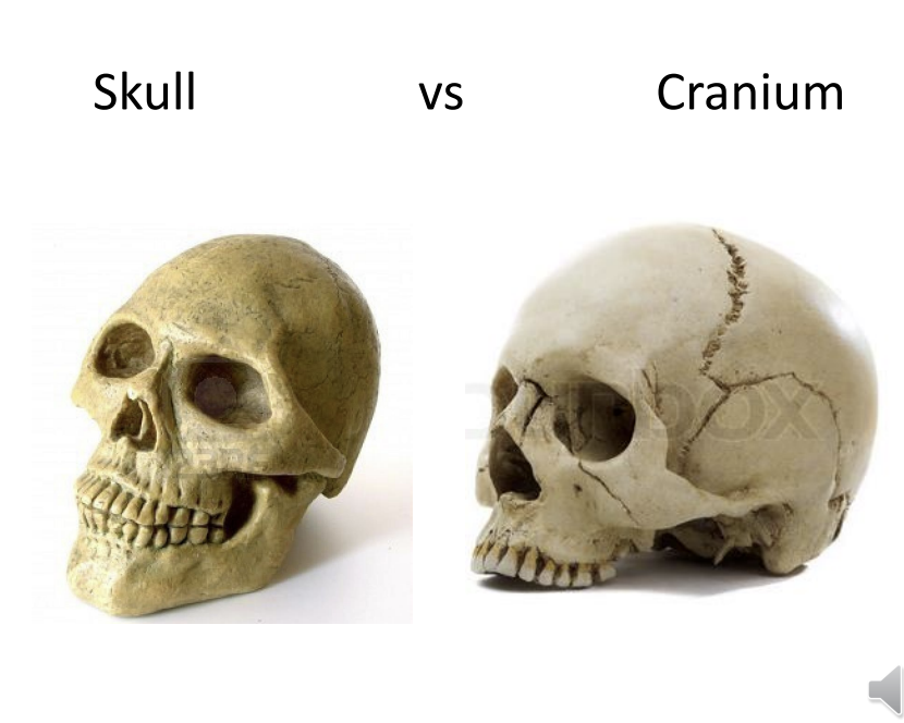 <p>skull has mandible attached</p>