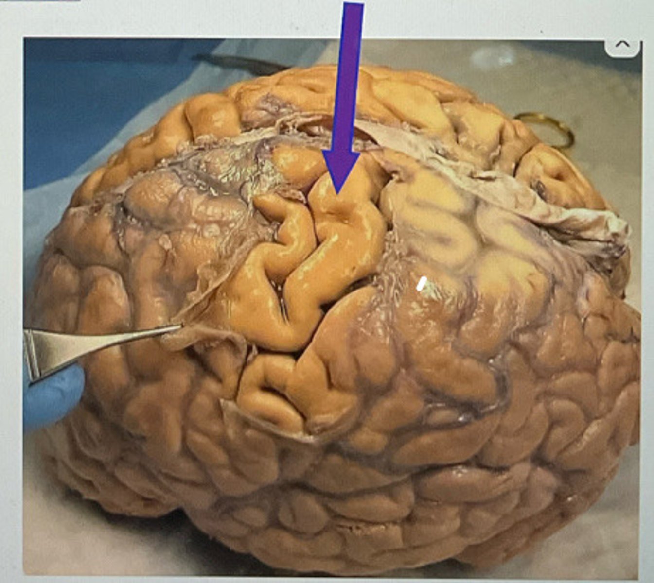 <p>shiny clear layer</p>