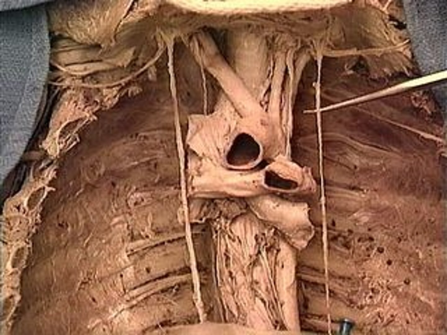 <p>innervate diaphragm</p>