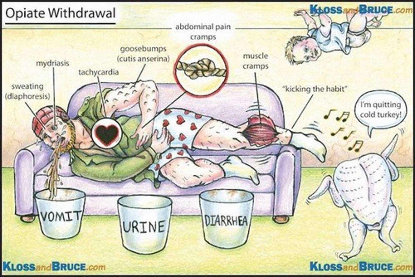 <p>Life-threatening condition from excessive opioid consumption.</p>