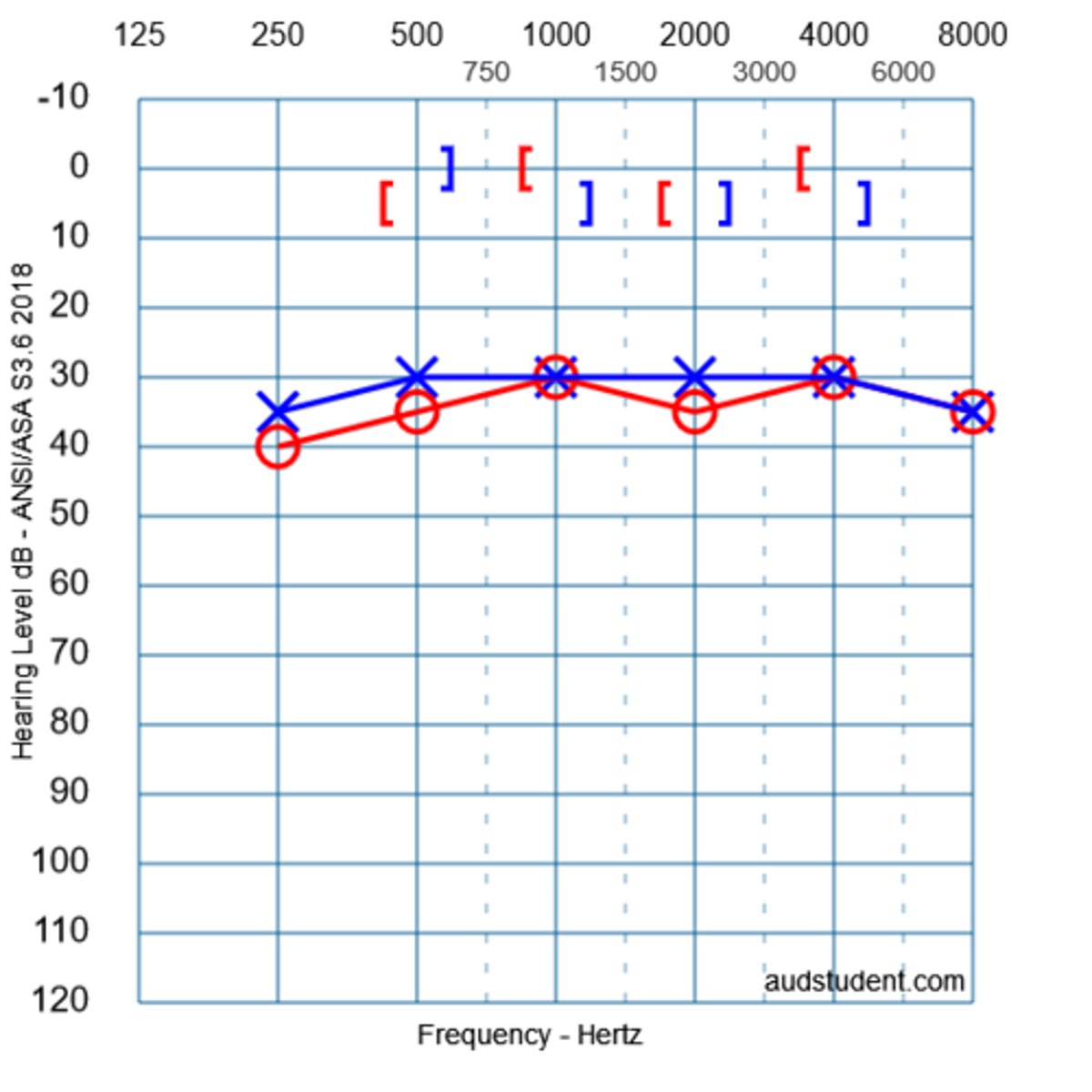<p>conductive HL</p><p>3 multiple choice options</p>