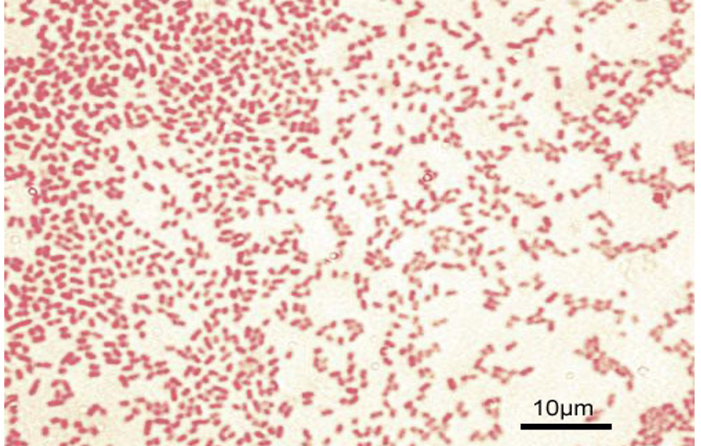 Escherichia coli (gram stain) 