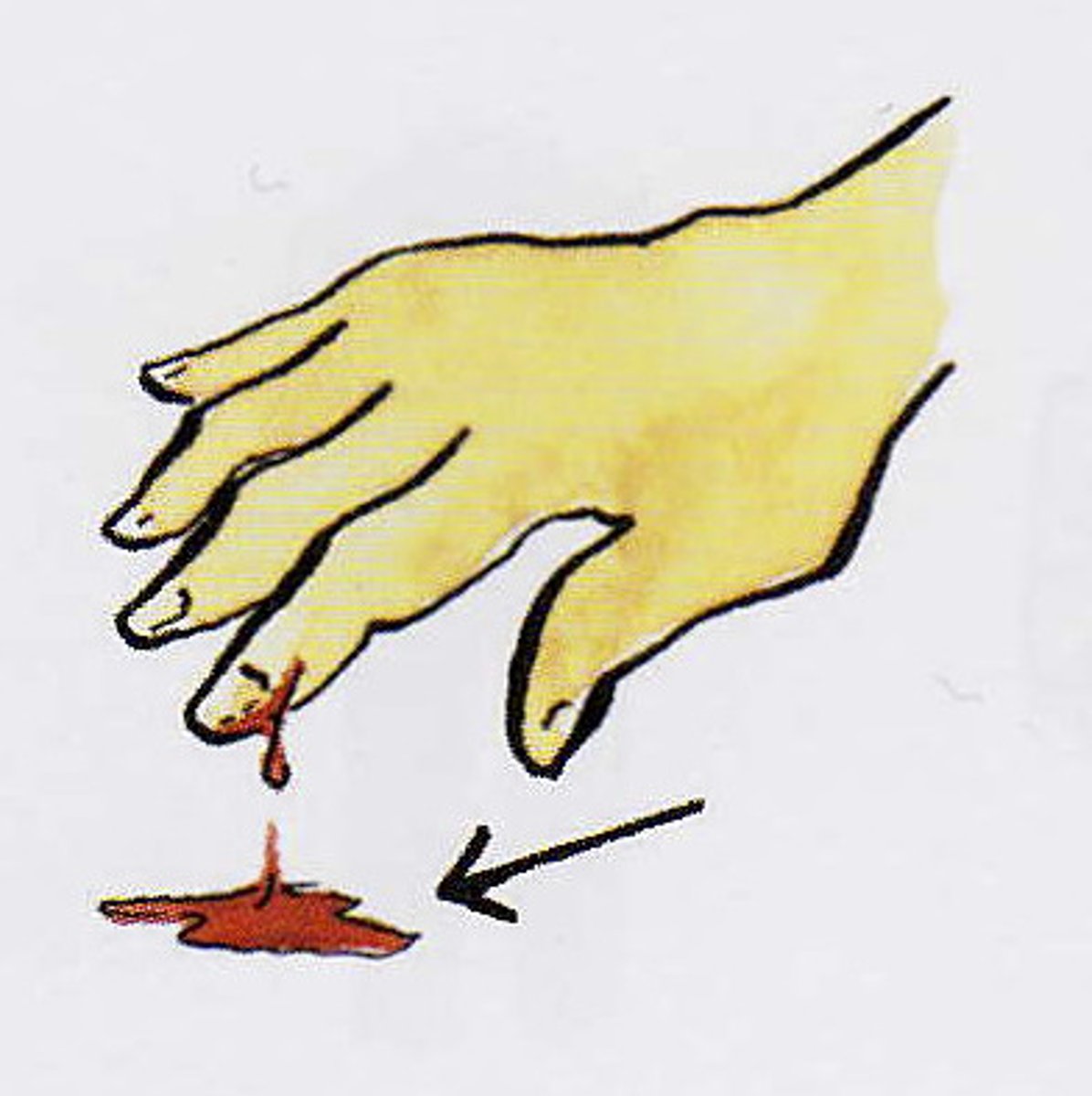 <p>кров</p>