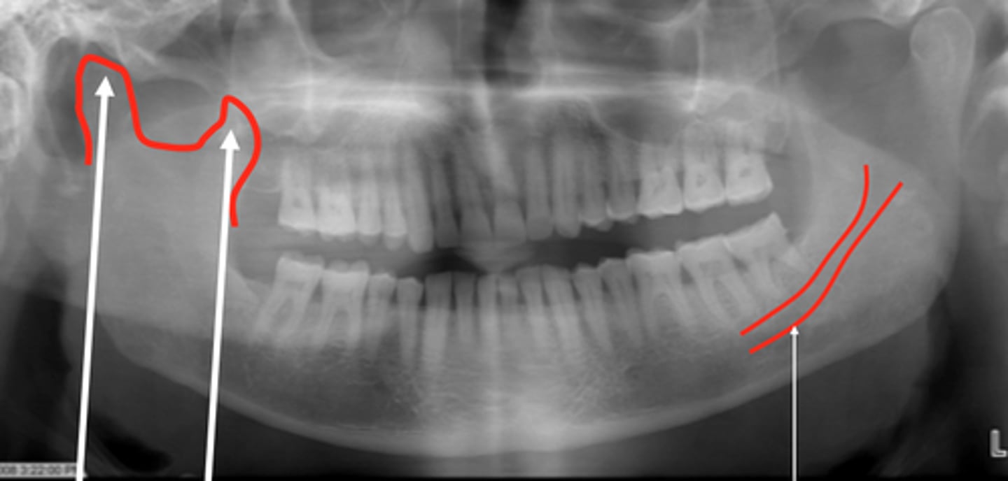 <p>Label from the left side of mouth to Right.</p>