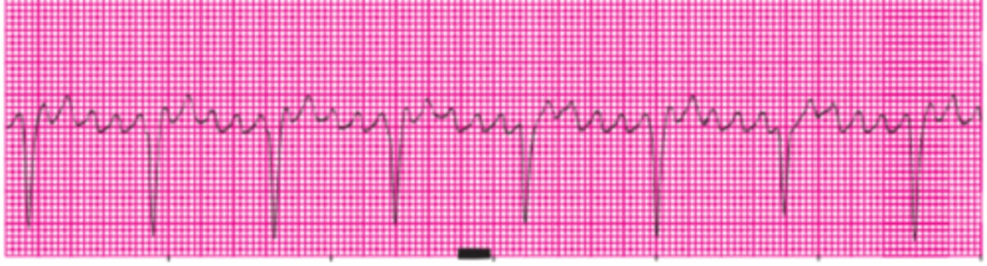 <p>Name this rhythm.</p>