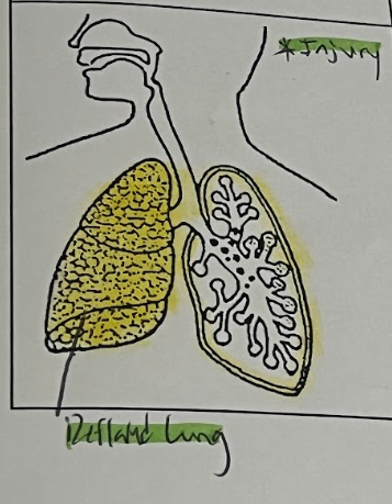 <p>Pleural (chest) Cavity &amp; lungs</p>
