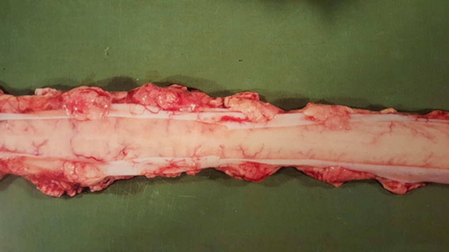 <p>Rygmarv fra okse. Patoanatomisk diagnose?</p>