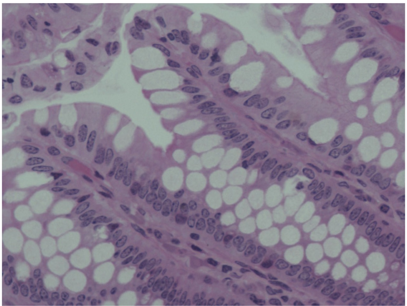 <p>A. ID the segment of the GIT</p><p>B. Name all the cell types and the predominant cell type </p>