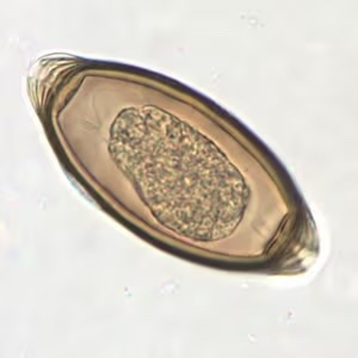 <p>Thick shell, polar plugs are each end</p>