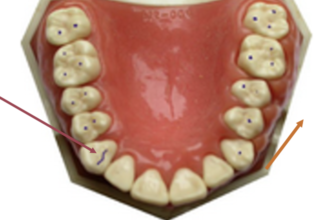 <p>What is the lef arrow pointing at</p>