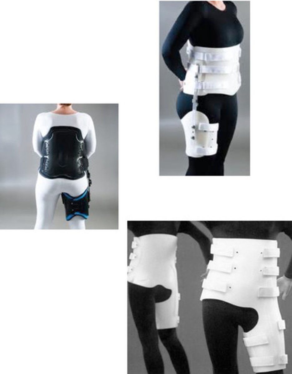<p>thigh cuff connected to spinal orthosis (rigid or with joint)</p><p>custom of prefabricated</p><p>hip joint ROM set by MD (typically limited to 30-60 degrees of locked at 45 degrees)</p>