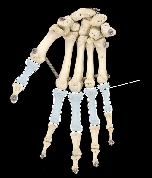 <p>Name this group of bones (be specific).</p><p>(Anterior view, right side).</p>