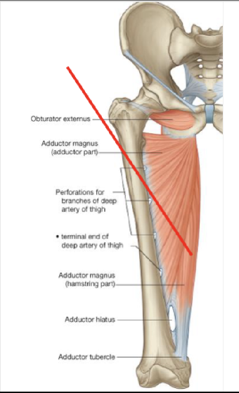 <p>Adductor Magnus (hamstring component)</p>