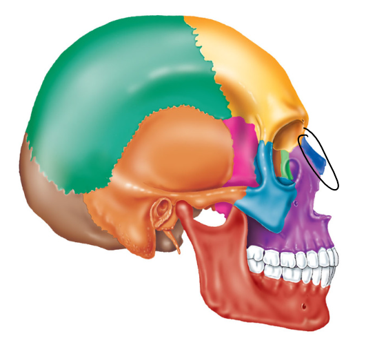 term image