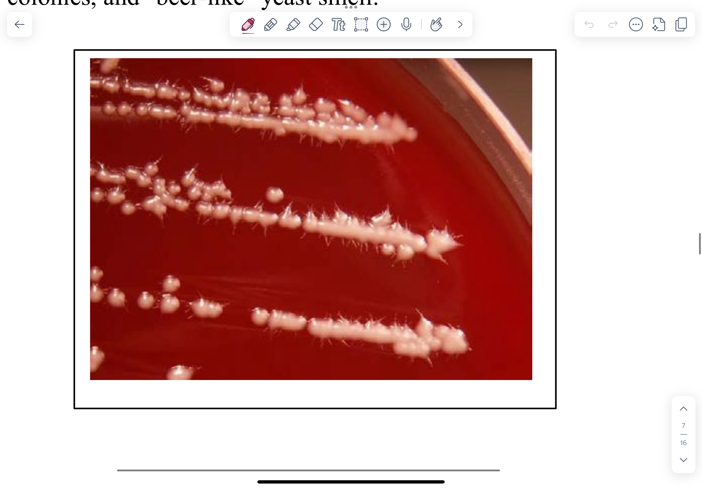 <ul><li><p>They grow readily on BA or Sabouraud agar (SAB)</p></li><li><p>Cream coloured, shiny, bacterial-like colonies. Has a beer-like yeast smell. Do not mix up with staphylococcus.</p></li></ul><p></p>