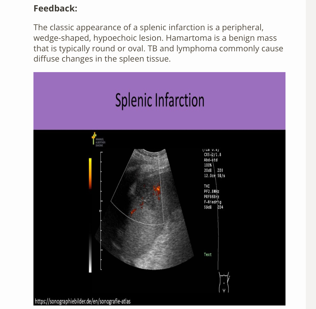 <p>A) infarction </p>