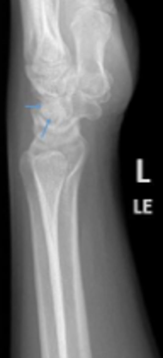 <p>What is the arrow pointing to?</p>