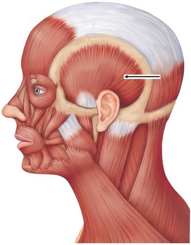 <p>muscle on your temporal bone</p>