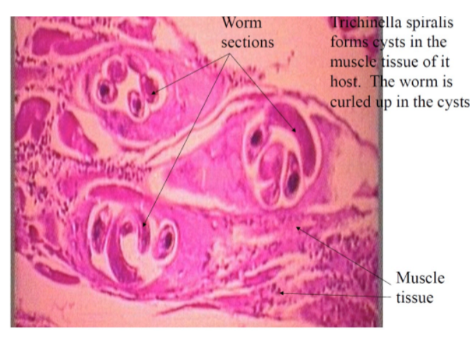 <p><strong><em>Trichinella spiralis</em></strong><em> —</em></p><ul><li><p>What <strong>category&nbsp;</strong>does it belong to?</p></li><li><p>What kind of <strong>reproduction method</strong> does it have?</p></li><li><p>What <strong>disease </strong>does it cause?&nbsp;</p></li></ul><p></p>