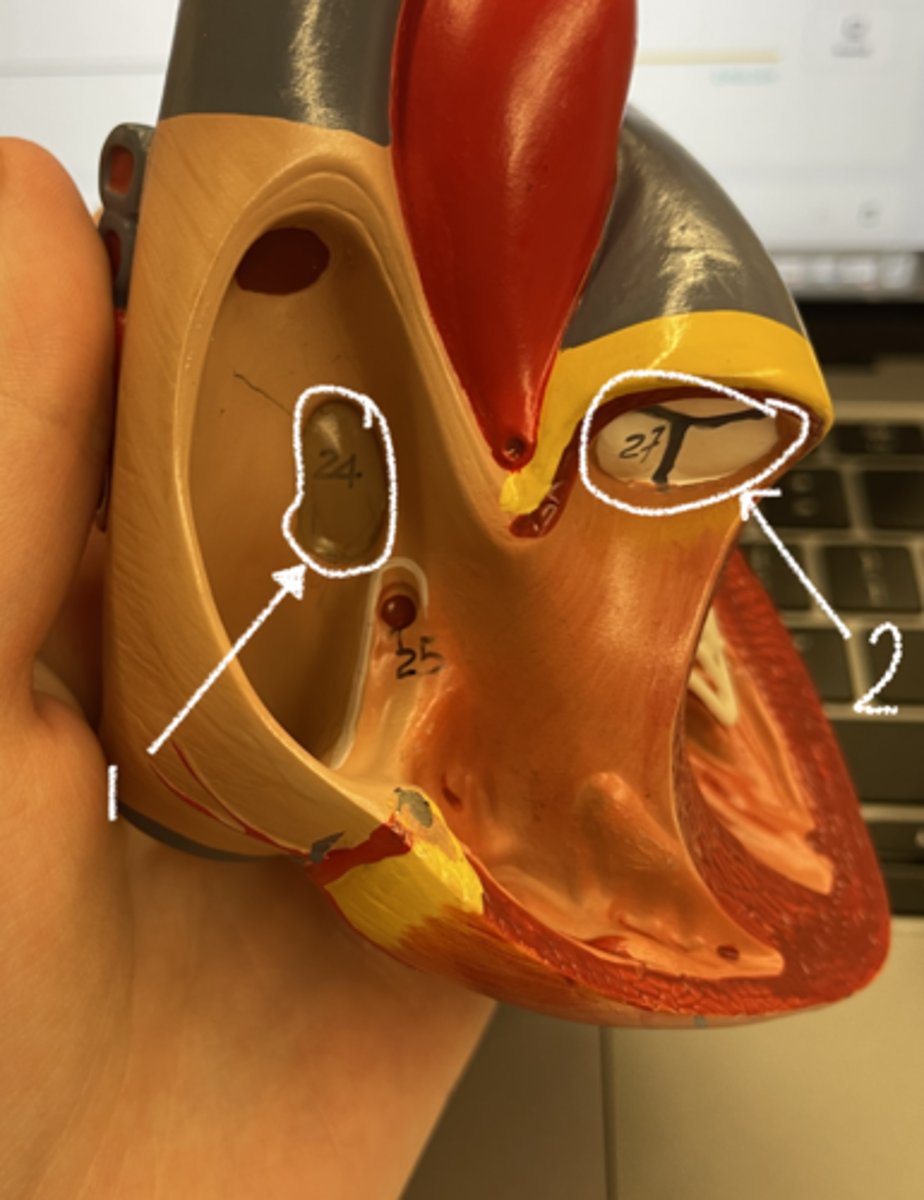 <p>what is structure 1</p>