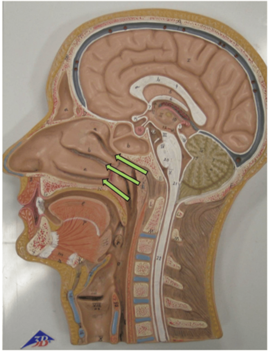 knowt flashcard image