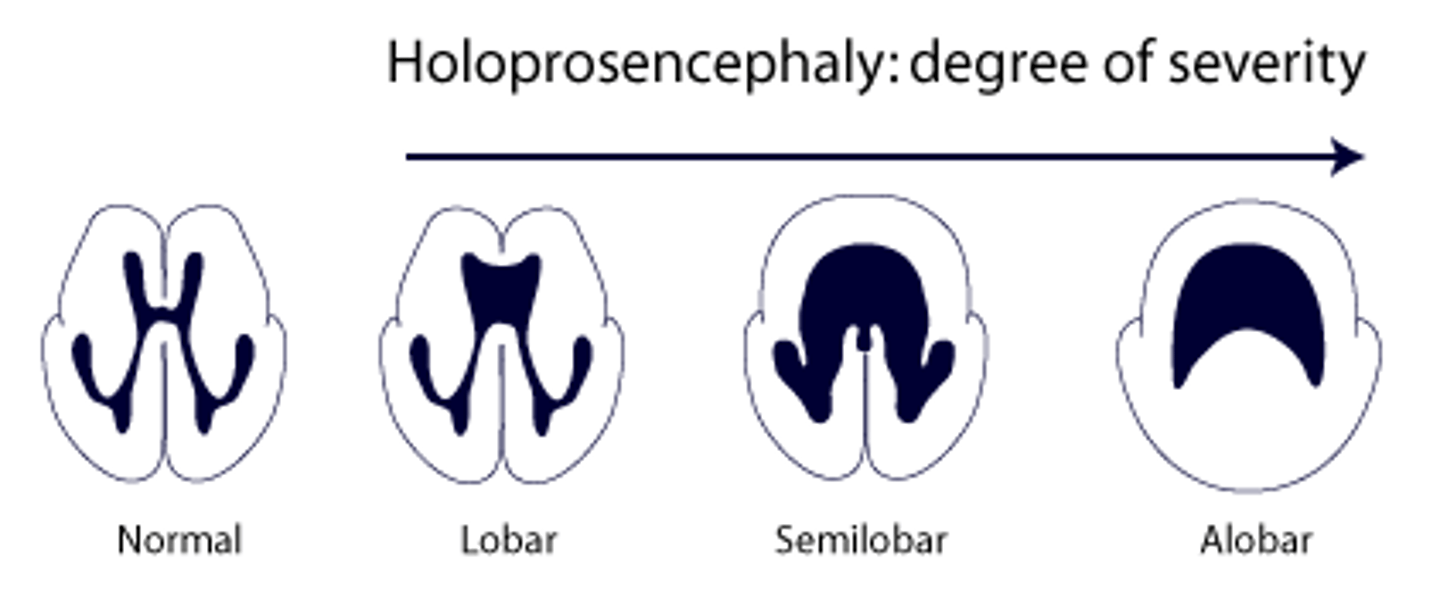 <p>Lobar, Semilobar, and Alobar (most severe), associated with Trisomy 13/Patau.</p>