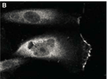 <p>post-translational phosphorylation; activated form of proteins; roles in leukocyte adhesion, motility, and extravasation during the inflammatory response. Mediated through the binding of ligands</p>