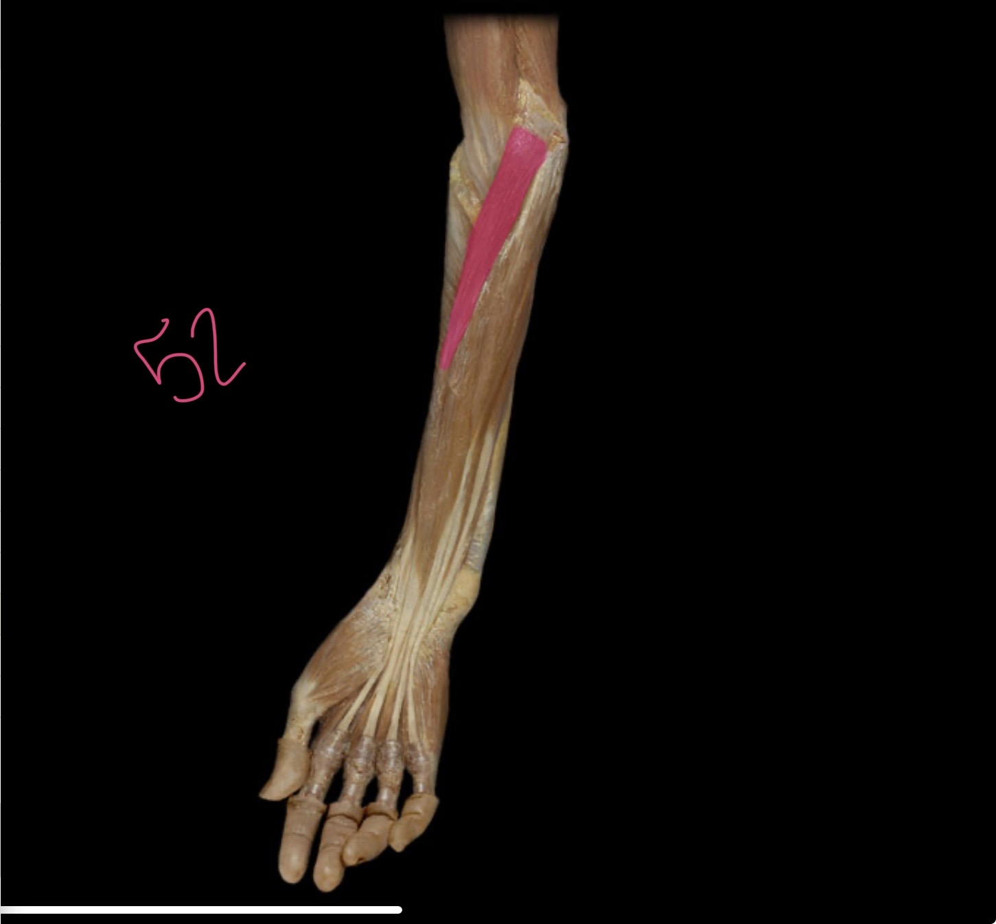 <p>Pronator Teres</p>