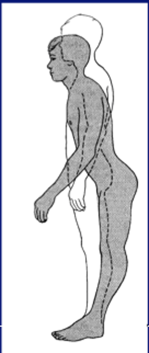 <p>- Postural sway control from hip, pelvis, trunk</p><p>- Head and hips travel in opposite directions (Counterbalance)</p><p>- Used when movement is large, fast, nearing limit of stability</p><p>- Surface is too narrow or unstable to allow counter pressure</p><p>- NO ANKLE STRAT</p>