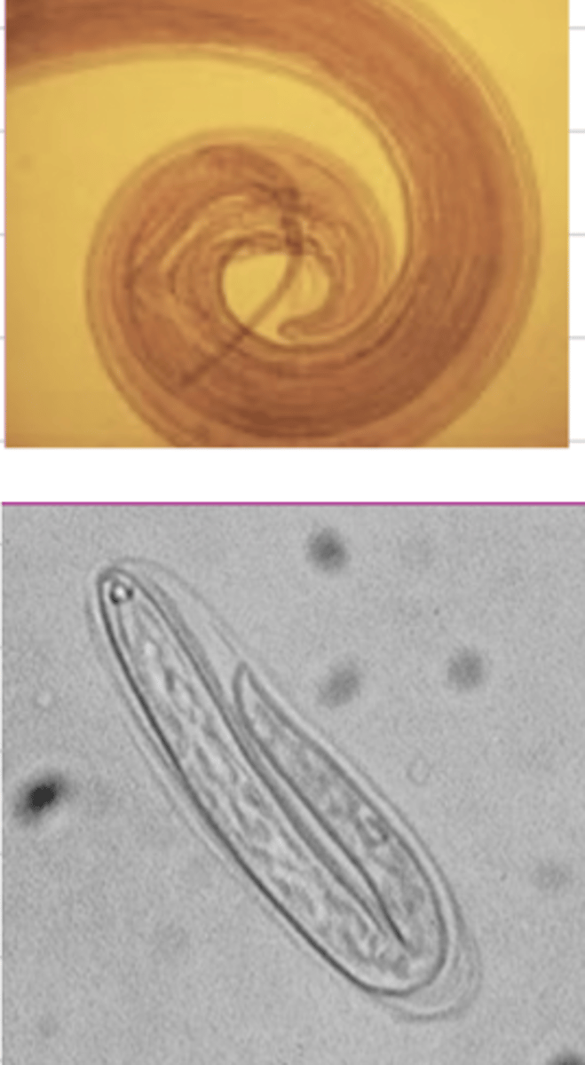<p>this is the tail and the egg of a parasite belonging to what superfamily in spirurida?</p>