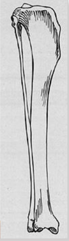 <p>van welk dier is dit de tibia en de fibula</p>
