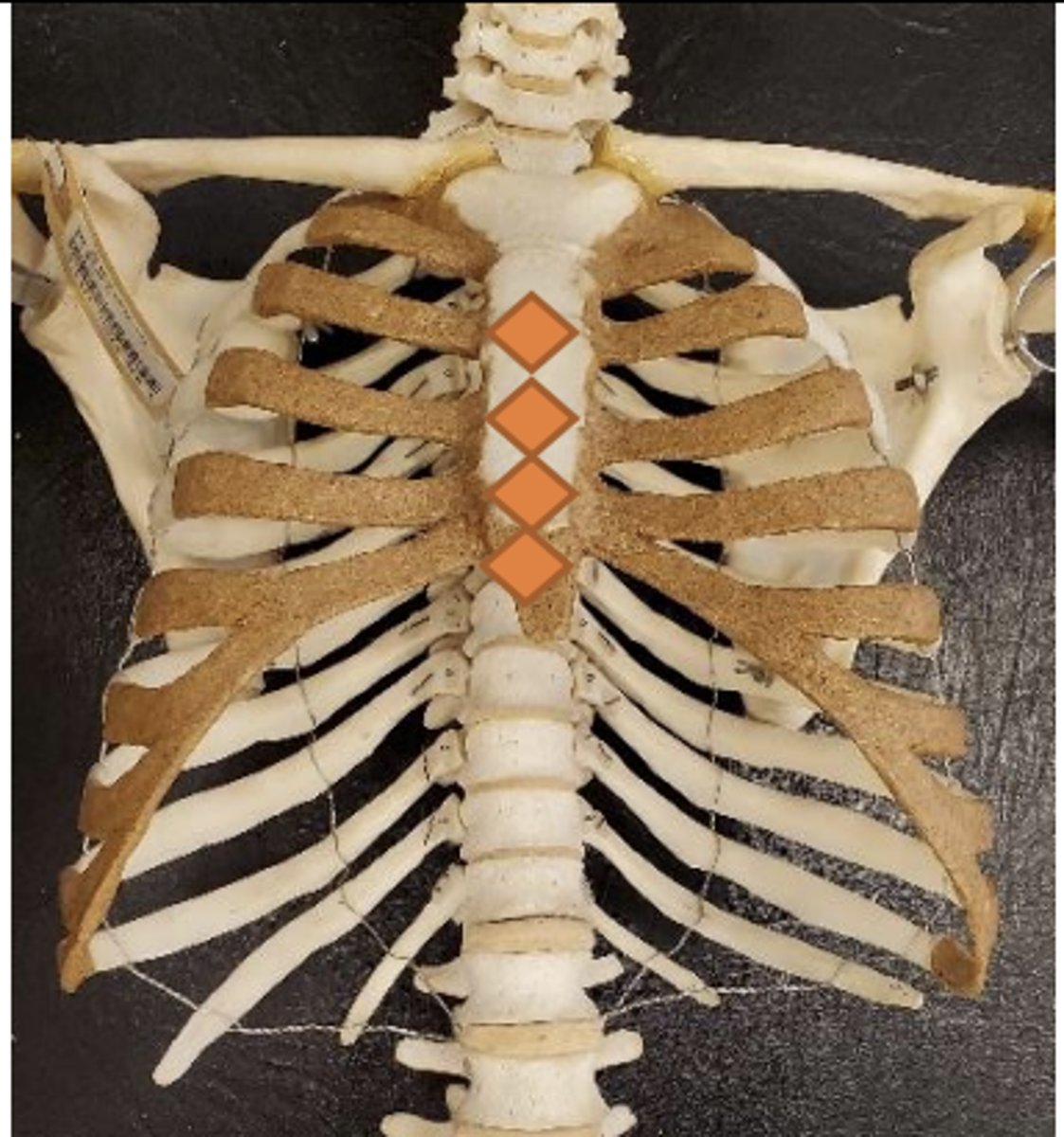 <p>on sternum at appropriate level (midline or just lateral to)</p>