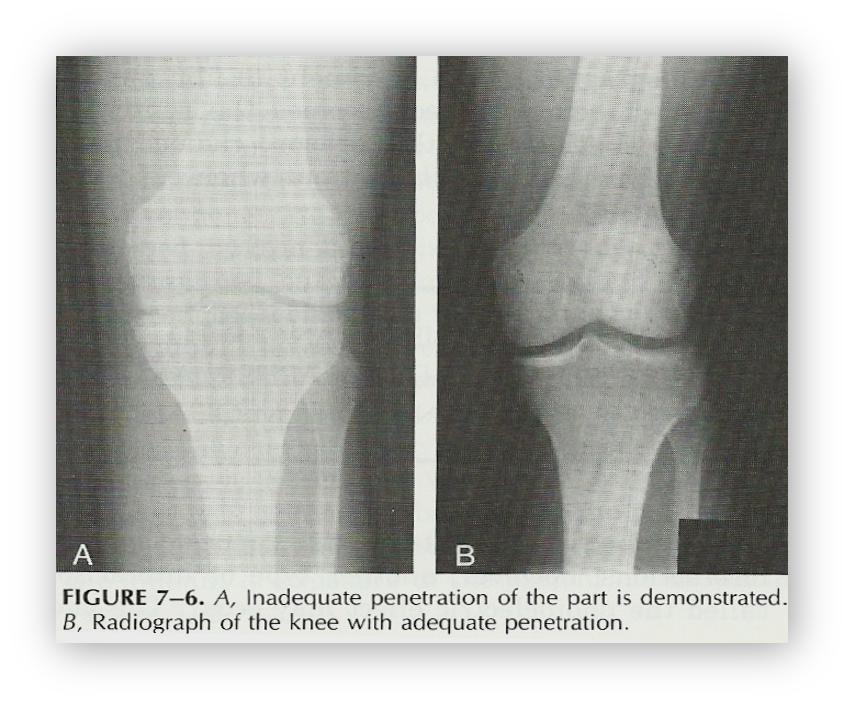 <p><span>x-ray photons have sufficient energy to pass through the part and emerge as remnant radiation </span></p>