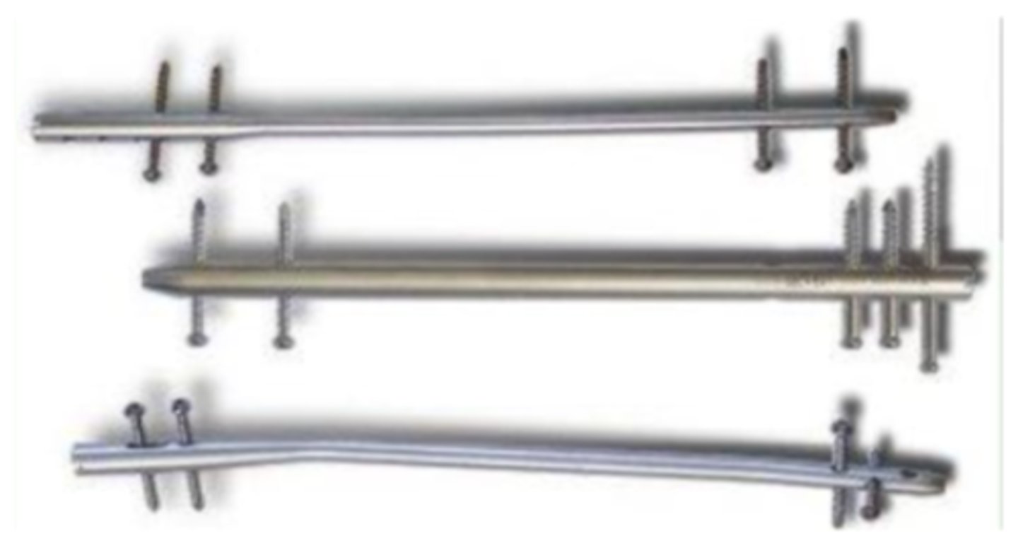 <p>fracture of middle third of long bone</p>