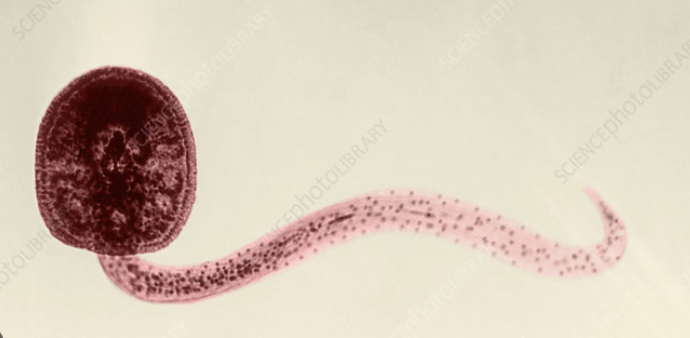 <p>final stage of larvae fasciola hepatica</p><p>seeks for host to infect</p>