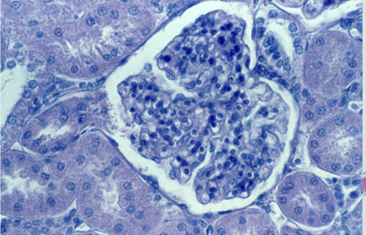 <p>simple squamous epithelium</p>
