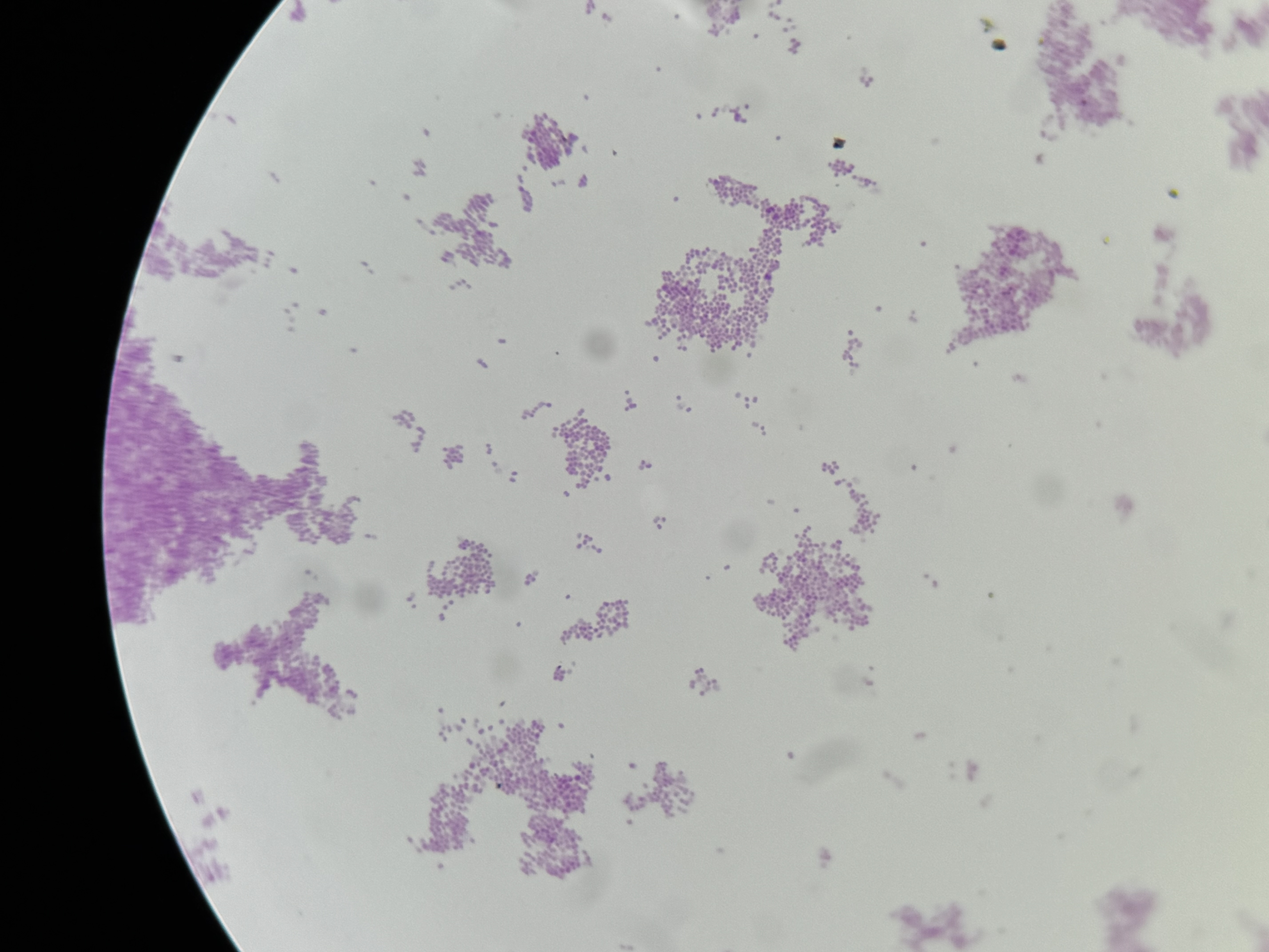 <p>Neisseria gonorrhoeae</p>