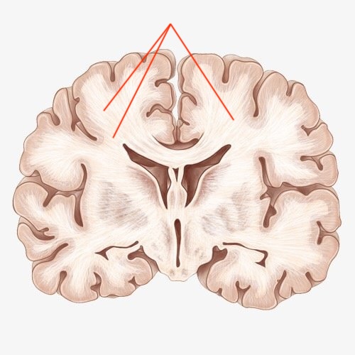 <p>Type of tissue that is found in the deeper tissues of the brain (subcortical)<span>; contains nerve fibers (axons), which are extensions of nerve cells; Many of these nerve fibers are surrounded by a type of sheath or covering called myelin</span></p>