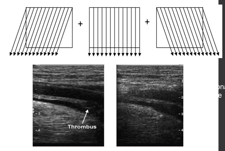<p>(1) multiple images formed at <strong><em>varying angles</em></strong> are created over time and then averaged to create one image</p><p>(2) the more frames averaged, the better the image quality</p>