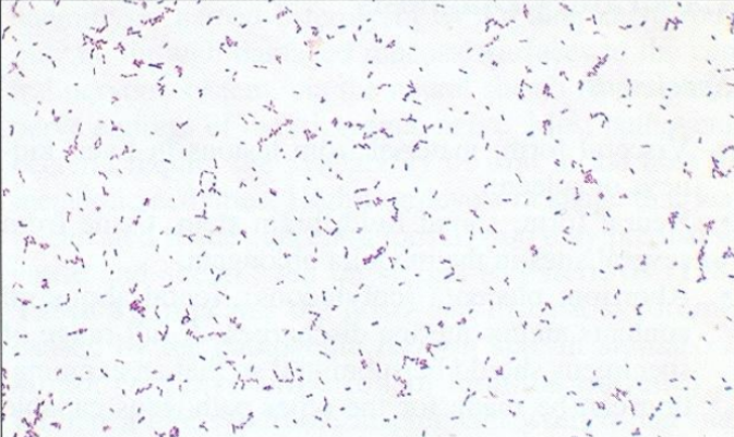 <ol><li><p><em><u>Listeria monocytogenes</u></em></p></li><li><p>both G+ rods &amp; cocci</p></li></ol><p></p>